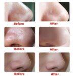 ⁦جهاز تنظيف وتدليك الوجه بعمق تاتش سيليكون يعمل بالبطاريات⁩ - الصورة ⁦8⁩