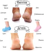 شراب جل لعلاج ومنع تشققات وخشونة القدم بزيوت وفيتامينات للتغذية والتنعيم - الصورة 5