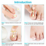 ⁦مصحح أظافر القدم لتقويمها وإعادتها لوضعها الطبيعي⁩ - الصورة ⁦5⁩