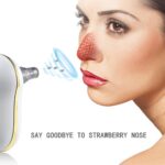 ⁦جهاز شفط وازالة الرؤوس السوداء ب5 رؤوس مختلفة - قابل للشحن⁩ - الصورة ⁦3⁩