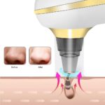 ⁦جهاز شفط وازالة الرؤوس السوداء ب5 رؤوس مختلفة - قابل للشحن⁩ - الصورة ⁦4⁩