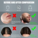 ⁦بكرة ديرما رولر مقاس  0.50 مم لتحفيز إنتاج الكولاجين وعلاج آثار الندبات⁩ - الصورة ⁦3⁩